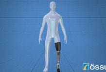 Bionic Legs Controlled By the Brain a Reality Ossur Prosthetic