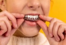 Achieve a Confident Smile with Sebaris Clear Aligners