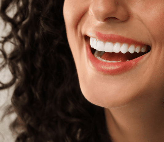 What Are Composite Veneers and Why Are People Ditching Braces for Them?