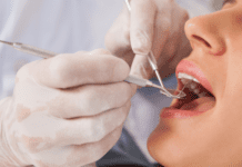 How To Compare Dental Implant Treatment Plans, Quality, And Total Cost